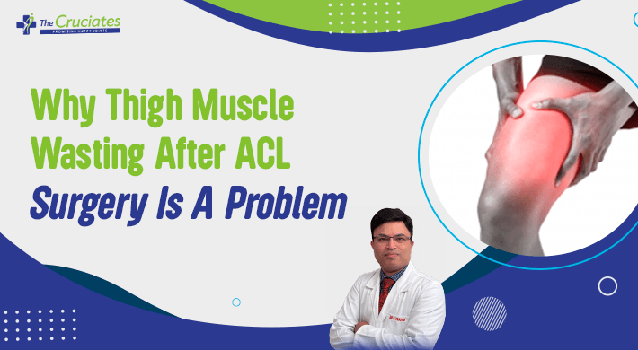 Why-Thigh-Muscle-Wasting-After-ACL-Surgery-Is-A-Problem