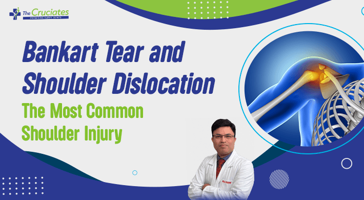 Bankart Tear and Shoulder Dislocation The Most Common Shoulder Injury
