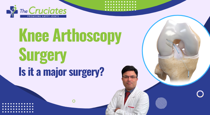 Knee Arthroscopy Surgery: Is it a Major Surgery?