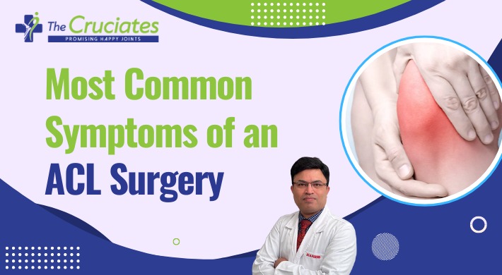Most Common Symptoms Of An ACL Surgery- Thumbnail
