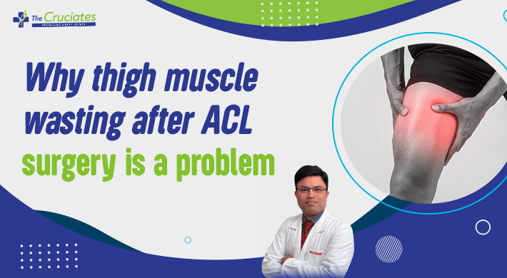 Why thigh muscle wasting after ACL surgery is a problem