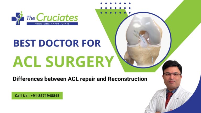 Best doctor for ACL surgery – Differences between ACL repair and Reconstruction