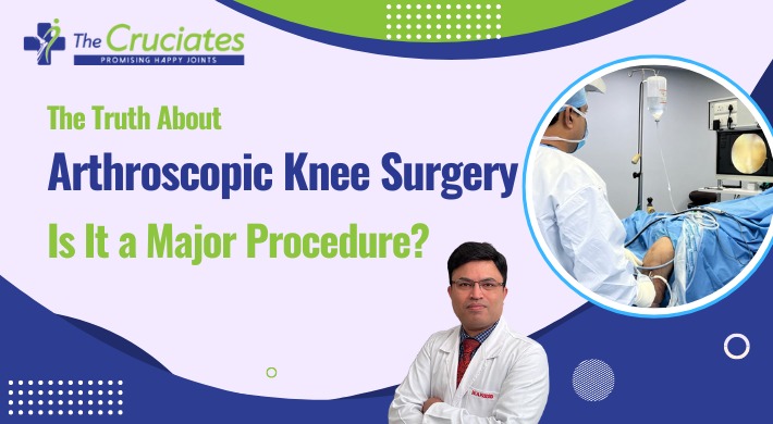 The Truth About Arthroscopic Knee Surgery: Is It a Major Procedure?
