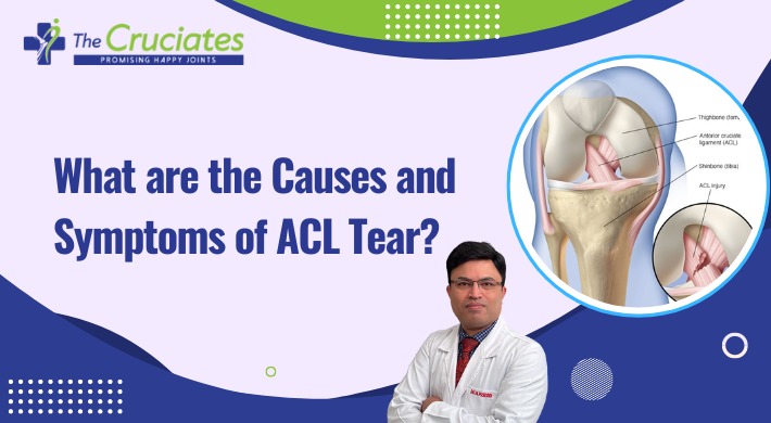 The Best ACL Surgeon in Delhi NCR: What are the Causes and Symptoms of ACL Tear?