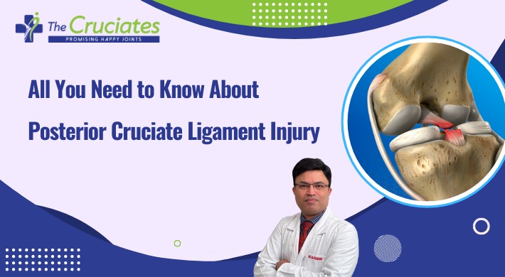 All You Need to Know About Posterior Cruciate Ligament Injury