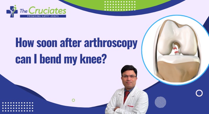 How Soon After Arthoscopy Can I Bend My Knee?