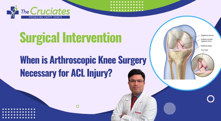 Surgical Intervention: When is Arthroscopic Knee Surgery Necessary for ACL Injury?