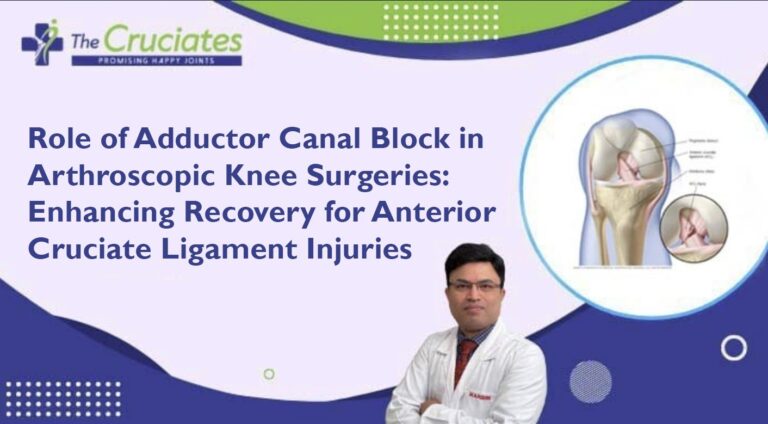 Role of Adductor Canal Block in Arthroscopic Knee Surgeries: Enhancing Recovery for Anterior Cruciate Ligament Injuries