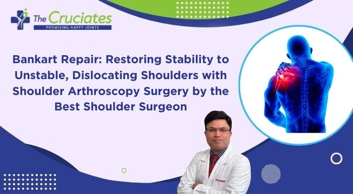 Bankart Repair: Restoring Stability to Unstable, Dislocating Shoulders with Shoulder Arthroscopy Surgery by the Best Shoulder Surgeon