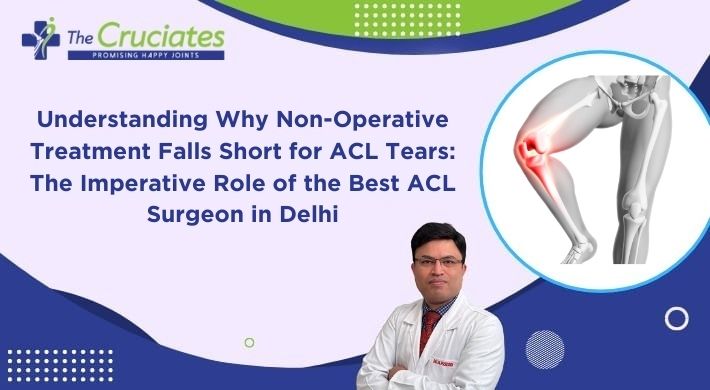 Understanding Why Non-Operative Treatment Falls Short for ACL Tears: The Imperative Role of the Best ACL Surgeon in Delhi